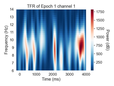Spectrogram of a single eeg channel